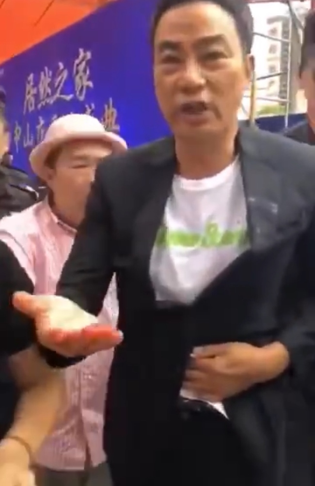 Hong Kong actor Simon Yam was stabbed in the stomach at an event in Zhongshan, Guangdong Province, on Saturday, July 20, 2019. [Photo: Zhongshan Public Security Bureau]