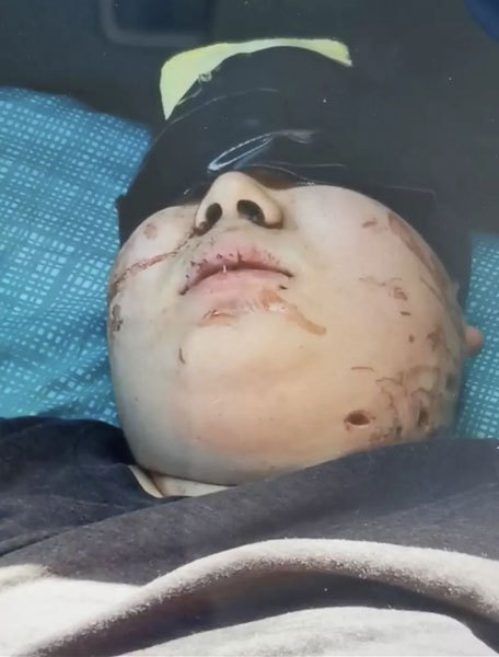 A screenshot from a video Ye Jingwang's father received showing Ye's blood stained face. [Screenshot taken by Nanfang Metropolis Daily]
