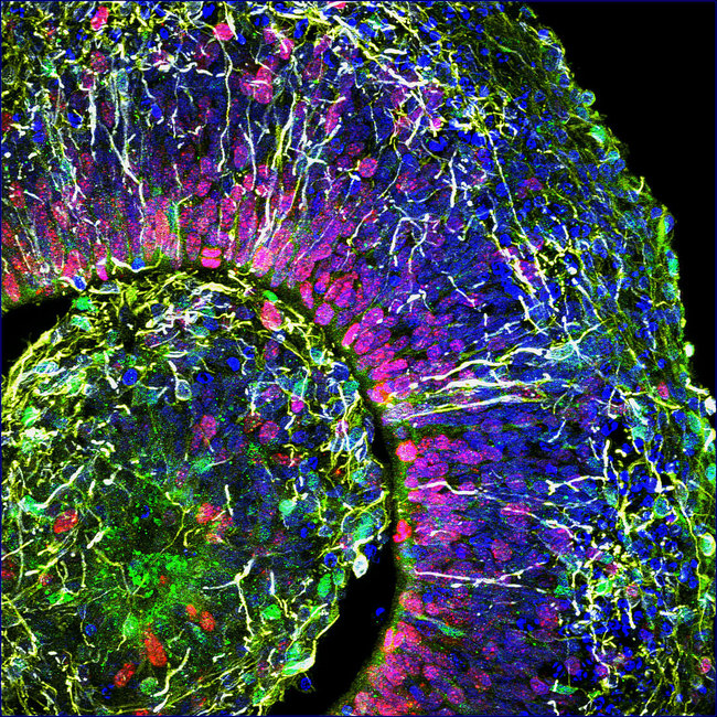 In this image recieved by on August 29, 2019 from Muotri Lab at UC San Diego, a cross-section of a brain organoid, showing the initial formation of a cortical plate, with each color marking a different type of brain cell. [Muotri Lab/UCTV/AFP via VCG]