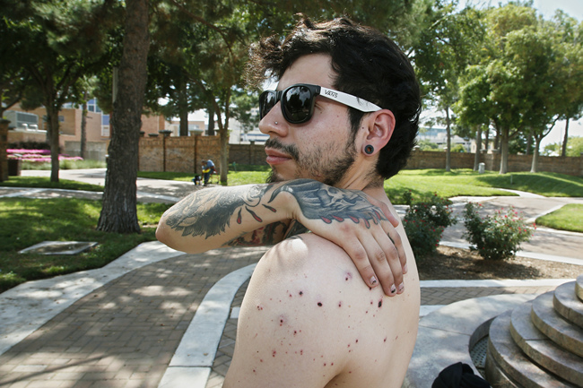 Daniel Munoz reaches for his injured back during an interview, Sunday, Sept. 1, 2019, in Odessa, Texas. Munoz was injured in Saturday's shooting. The tattoo on his right hand is a biblical reference, that the wages of sin are death and God's gift is everlasting life. [Photo: AP/Sue Ogrocki]